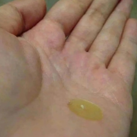 36 acne care/ Treatment/ pat ch - Picture 3 of 3